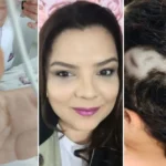 Mulher diz que ex debochou de medida protetiva antes de atirar na cabeça dela: 'isso não funciona'