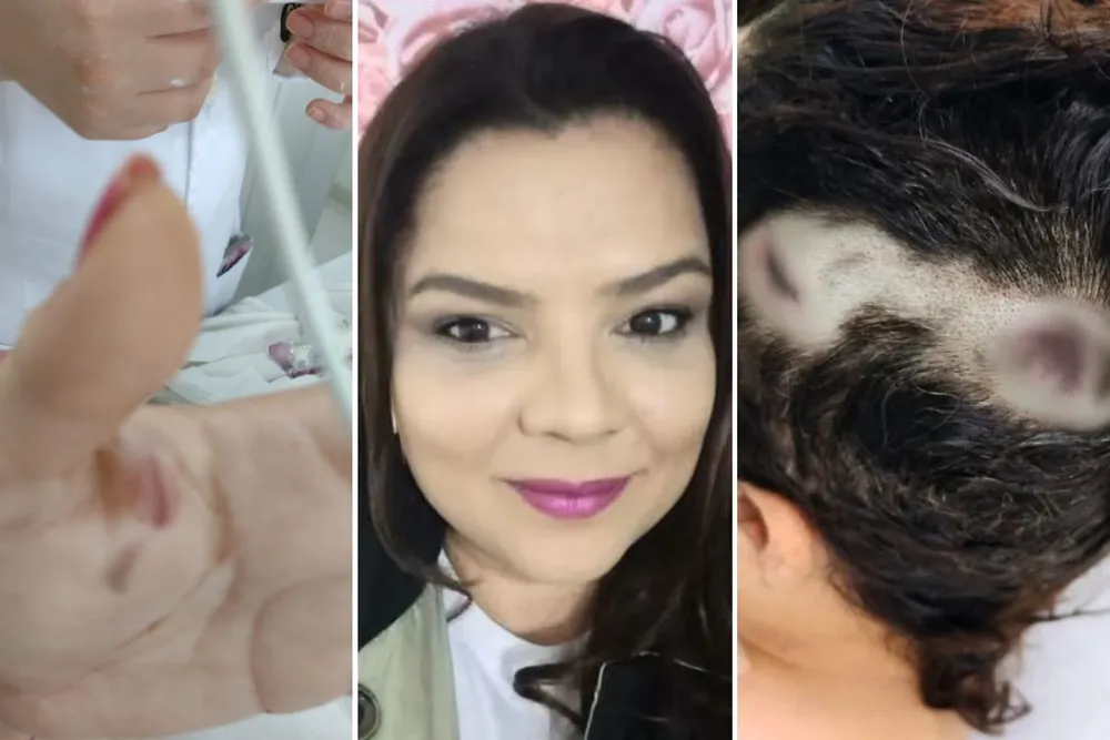 Mulher diz que ex debochou de medida protetiva antes de atirar na cabeça dela: 'isso não funciona'